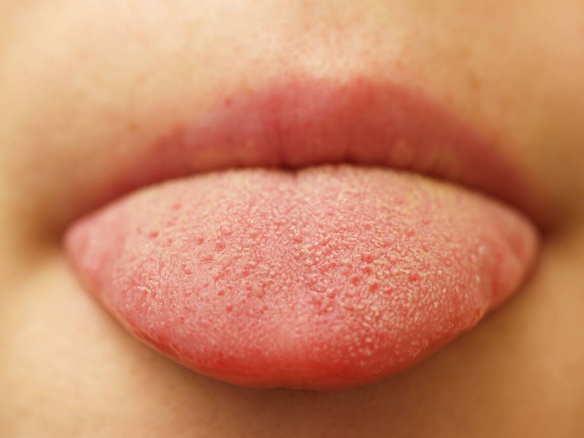 Foto: Esto es lo que el color de tu lengua dice de tu salud, según Harvard. (Foto: iStock)