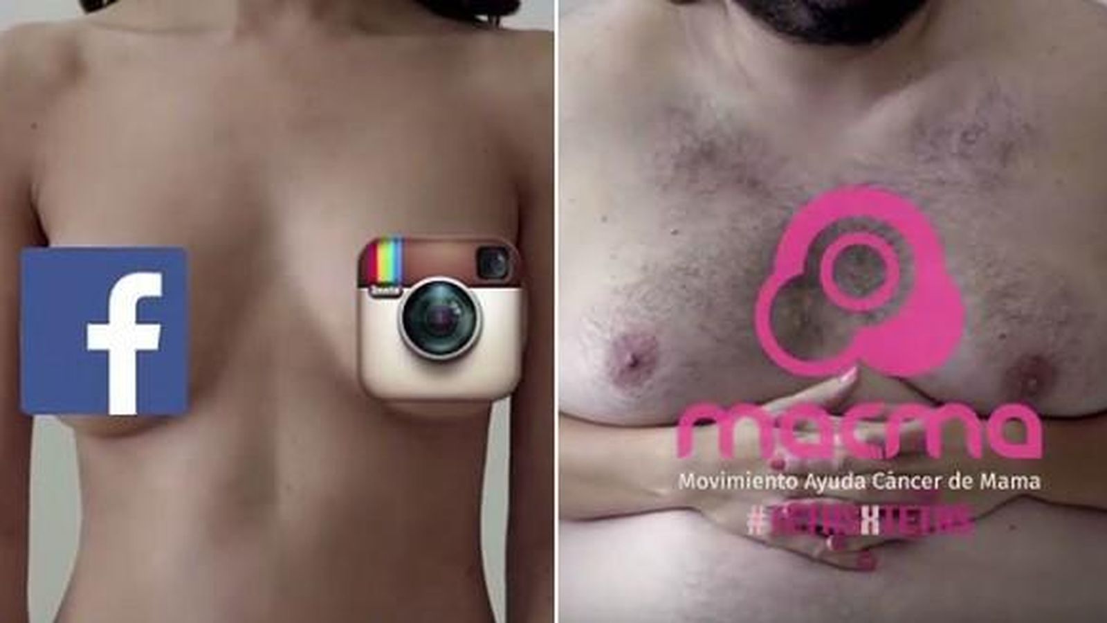 Foto: Campaña de sensibilización sobre el cáncer de mama  y las redes sociales, 'TetasxTetas'