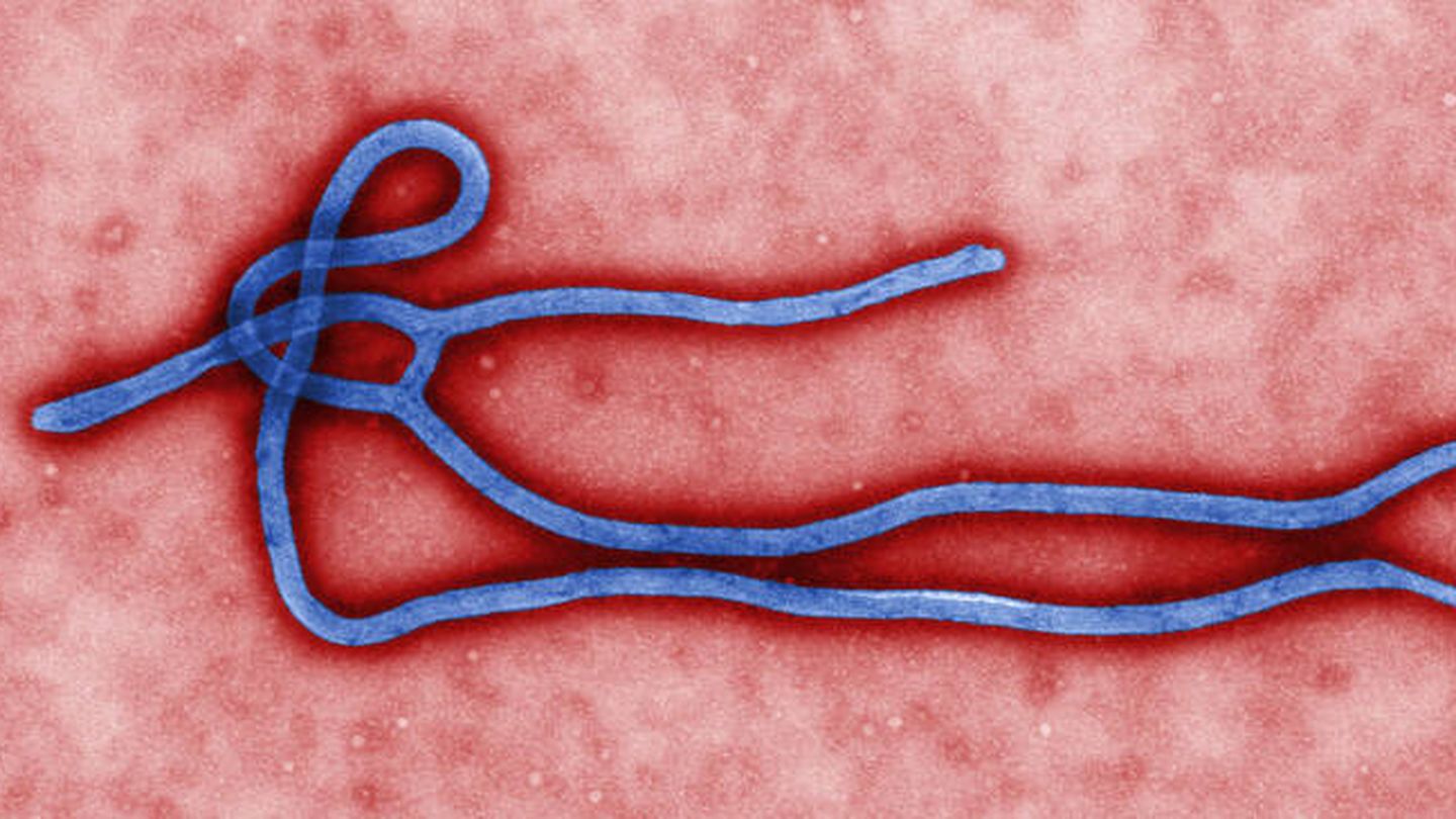 Virus del Ébola. (CDC)