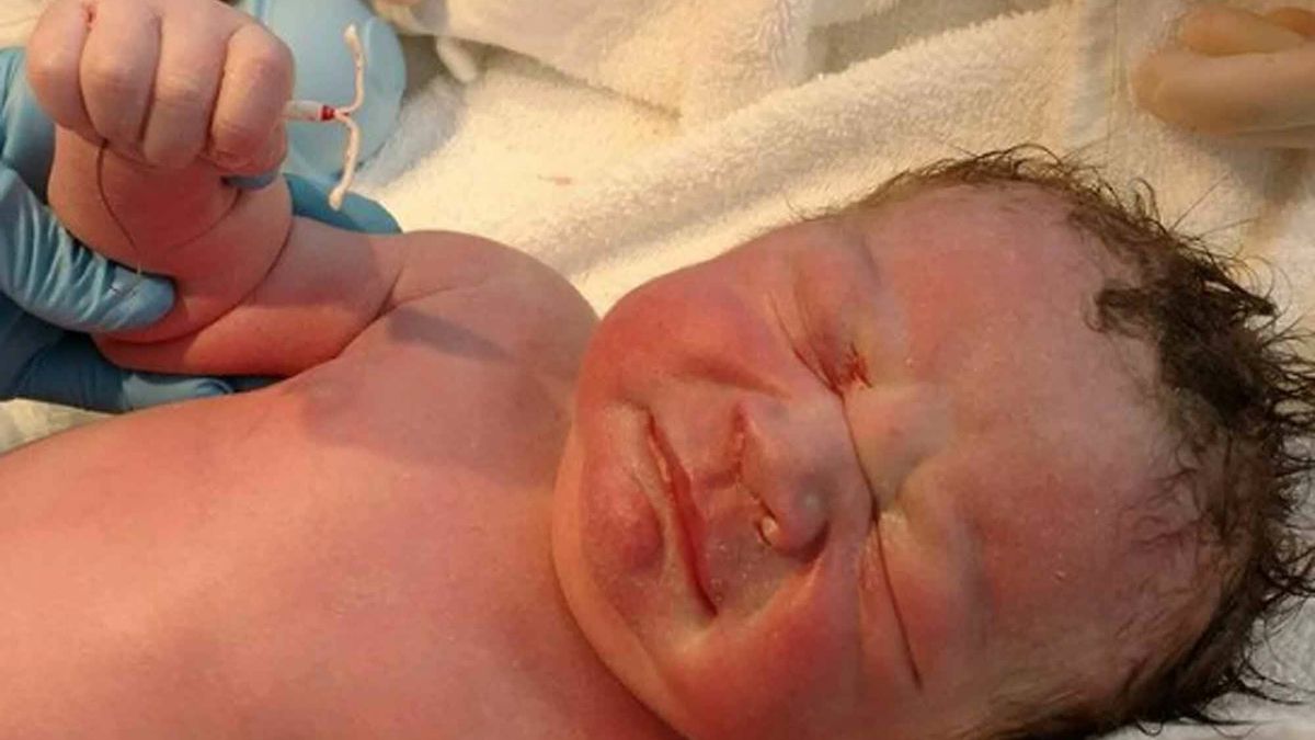 ¿Es posible que un bebé nazca con el DIU en la mano? La verdad tras los vídeos virales de TikTok