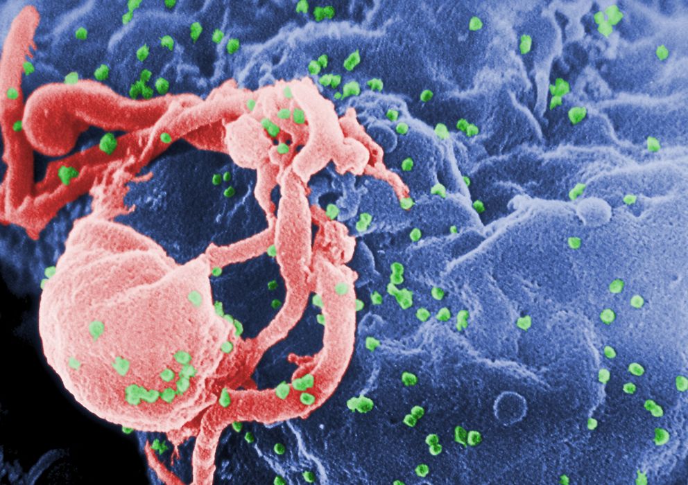 Foto: Viriones de VIH-1 (en verde) ensamblándose en la superficie de un linfocito. (C. Goldsmith)
