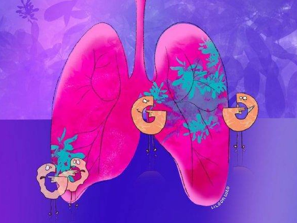 Foto: Los investigadores han demostrado que son capaces de retardar el crecimiento de los tumores pulmonares. Foto: Escuela Politécnica Federal de Lausana 