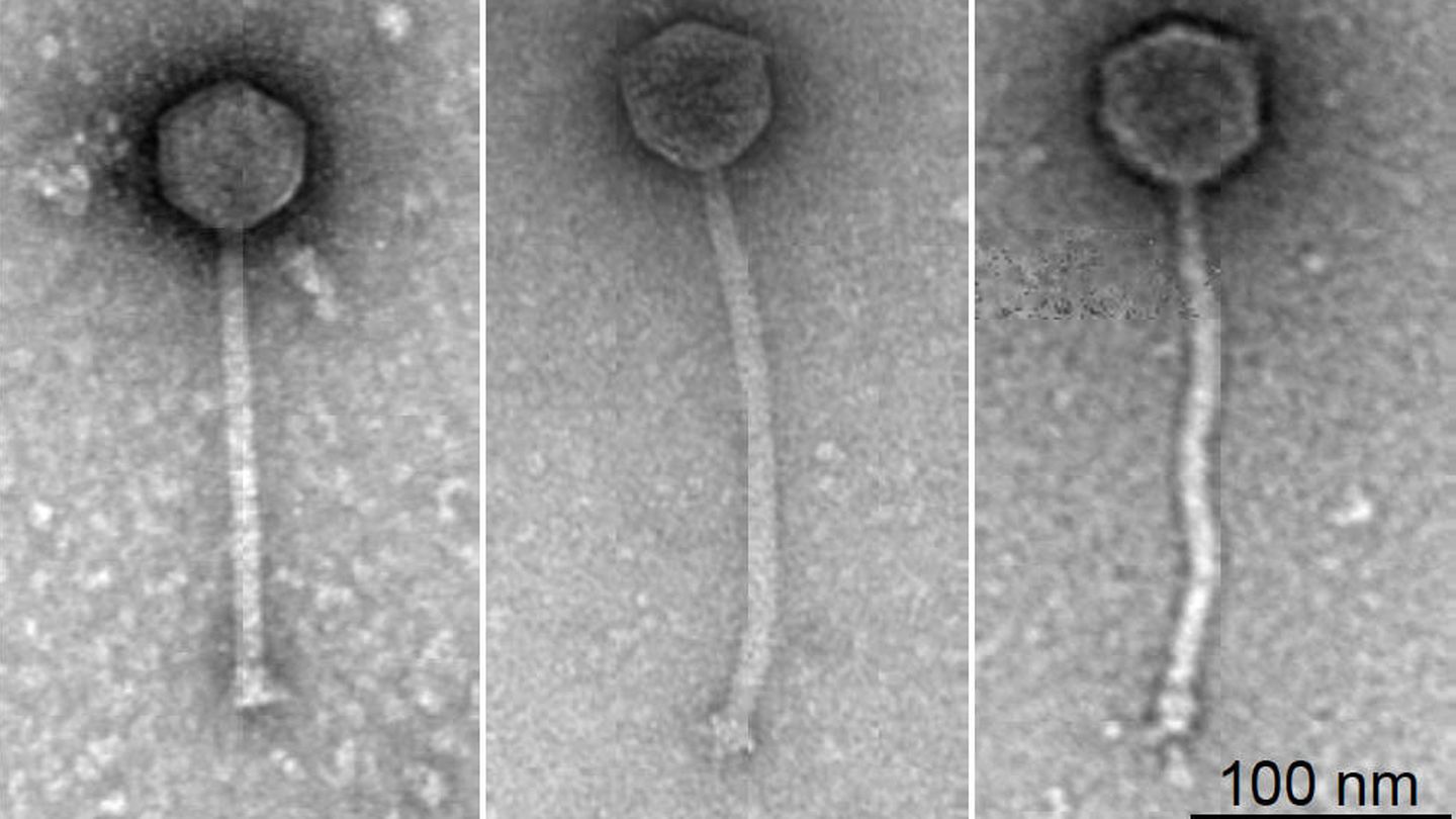 Primer plano de los fagos (R.M. Dedrick / Nature Medicine)