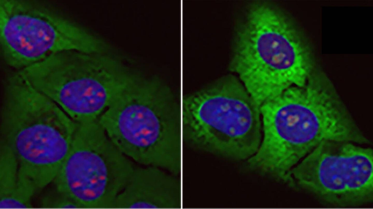 Células normales (izq.) y células sometidas al efecto de la proteína tóxica rica en arginina (dch.). (CNIO)