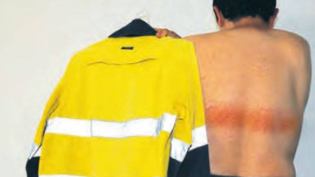Un ingeniero sufre quemaduras de primer grado por usar una chaqueta reflectante