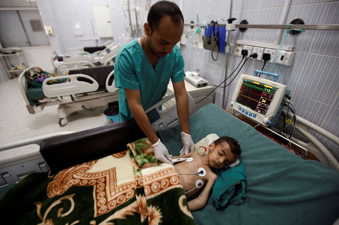Un enfermero atiende a un niño en Yemen. (Reuters)