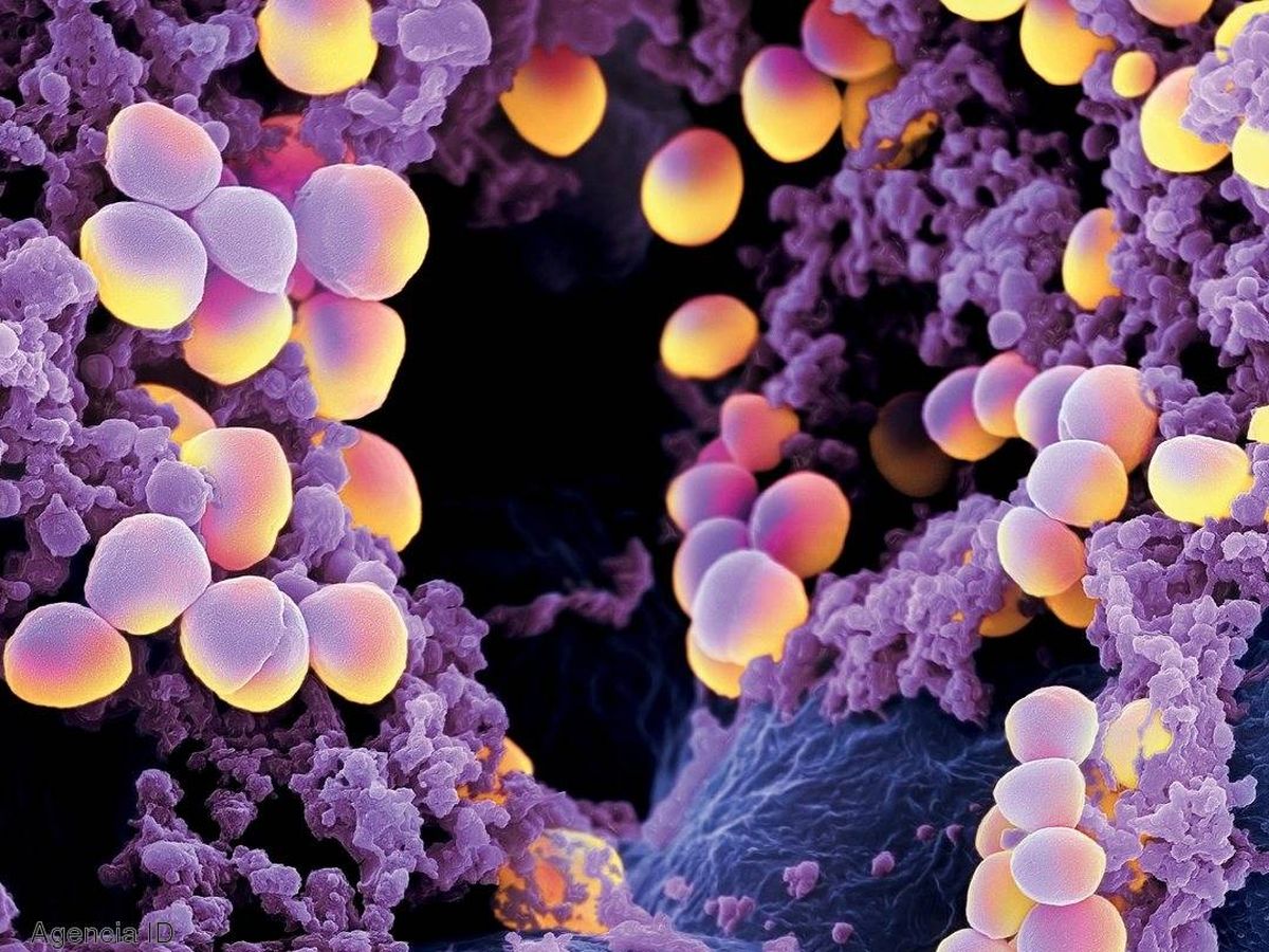 Foto: El estafilococo áureo, o dorado, es una bacteria  responsable de infecciones graves como la endocarditis y la neumonía.