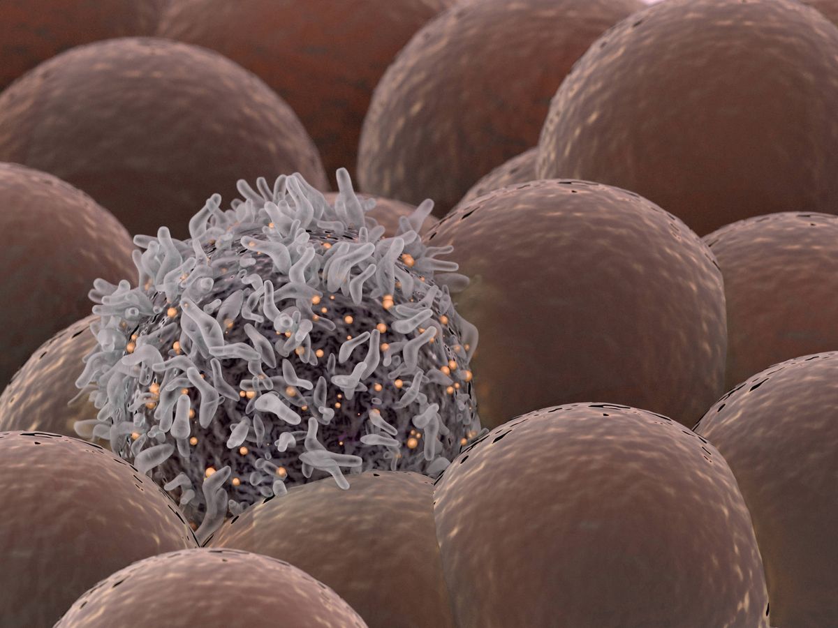 Foto: El aumento del óxido nítrico en el cuerpo se relaciona con el riesgo de cáncer. (iStock)