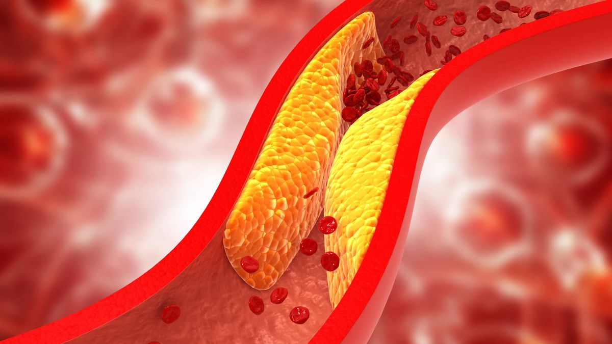 Estas son las formas naturales más sencillas de reducir tus niveles de colesterol