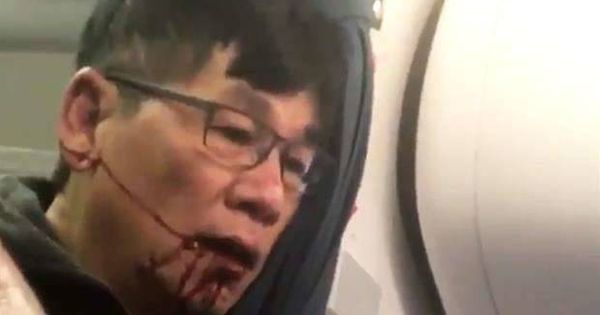 Foto: David Dao, con la boca llena de sangre, en el vuelo de United Airlines.