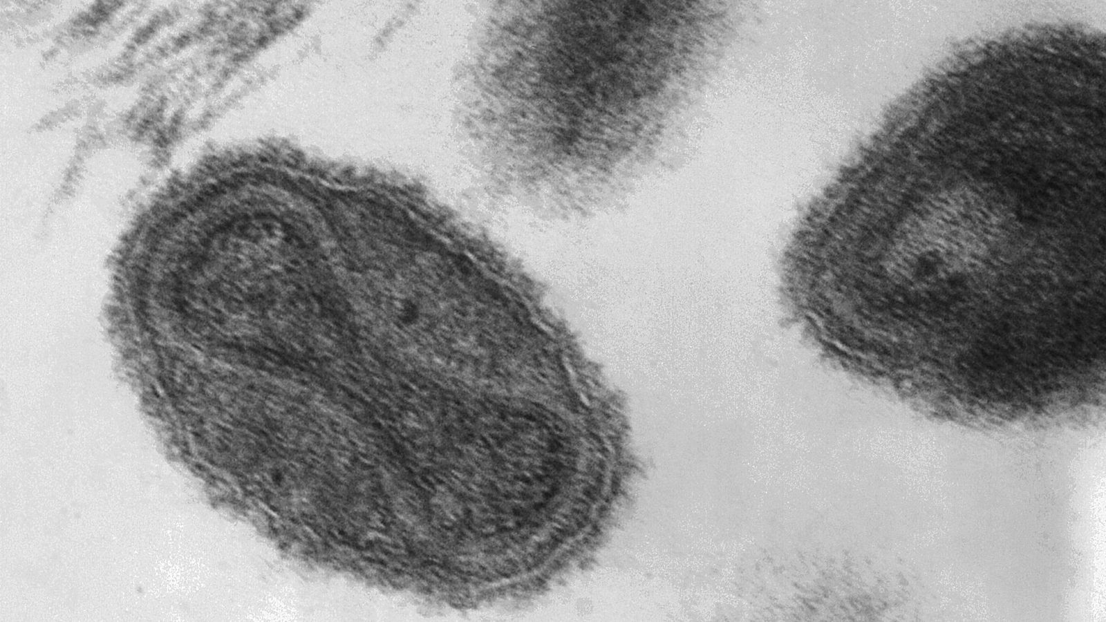 Virus de la viruela humana.