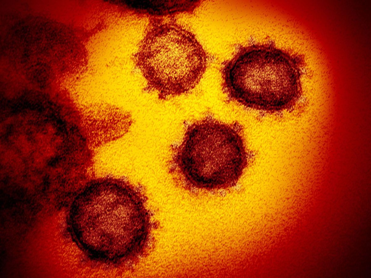 Foto: Imagen de microscopio del coronavirus facilitada por los institutos nacionales de salud de EEUU. (EFE)