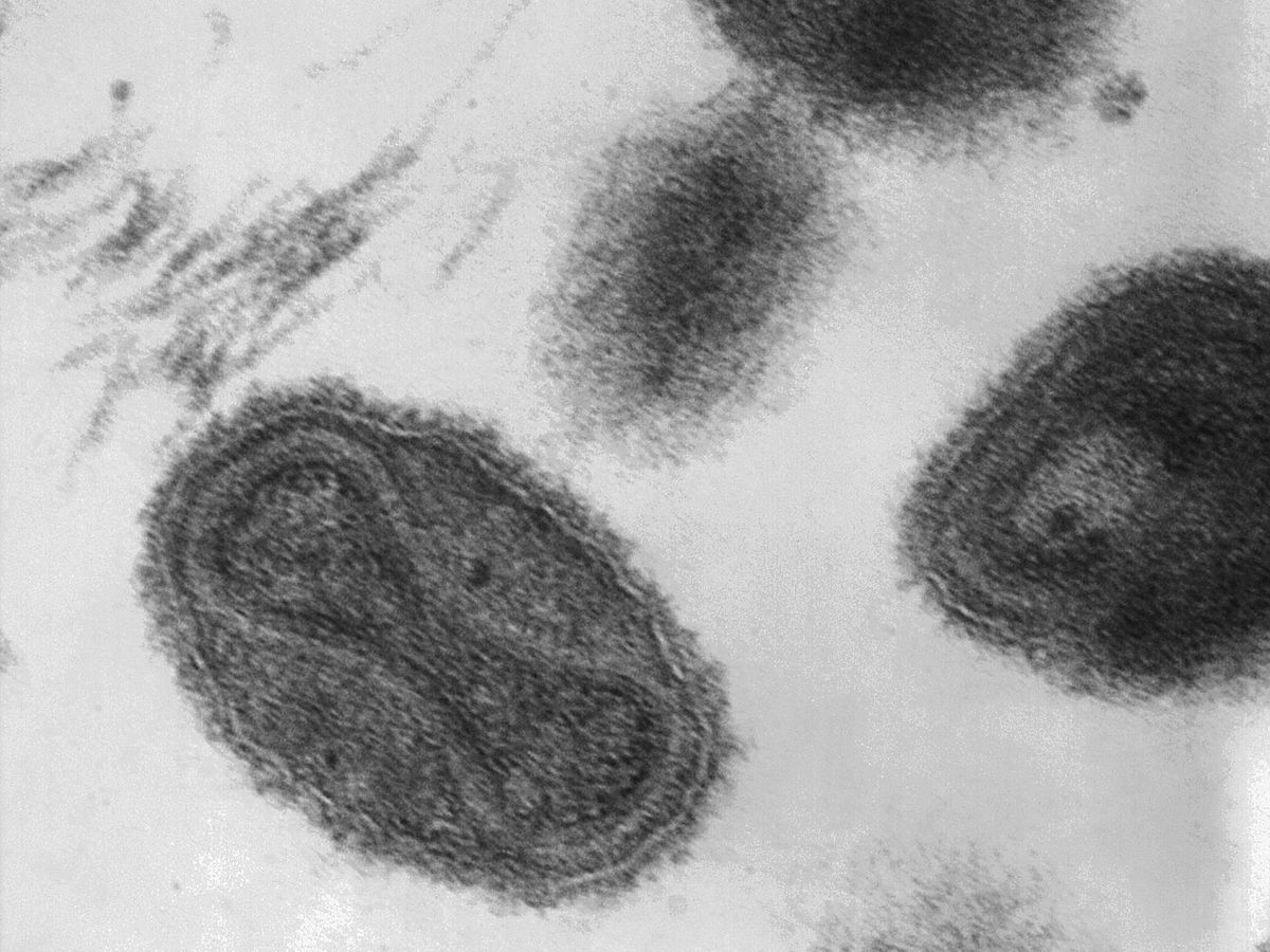 Foto: Es el virus de la viruela