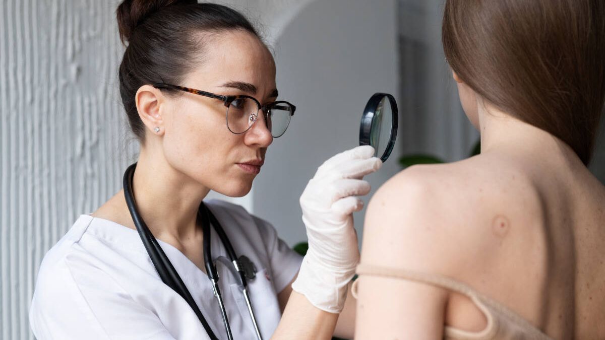 Lunares, manchas, cambios en la piel… ¿Cuándo es necesario acudir al dermatólogo?