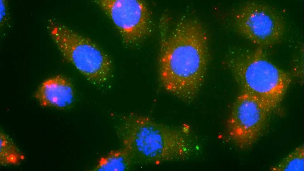 Las nanopartículas que aspiran a convertirse en una innovadora terapia contra el cáncer