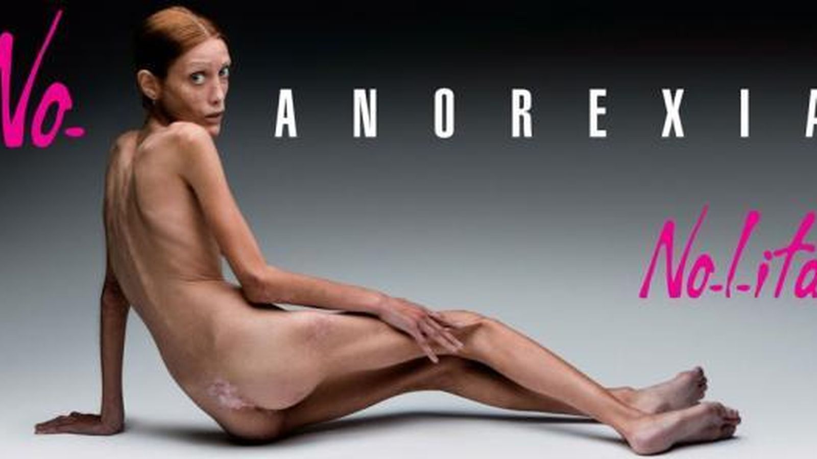 Foto: isabelle Caro, la modelo que protagonizó una campaña contra la anorexia en Francia (OLIVIERO TOSCANI)
