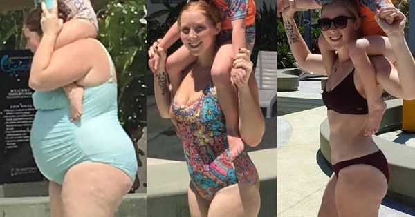 Foto: Tres imágenes que muestran el antes y el después de Keelly (Foto: Instagram)