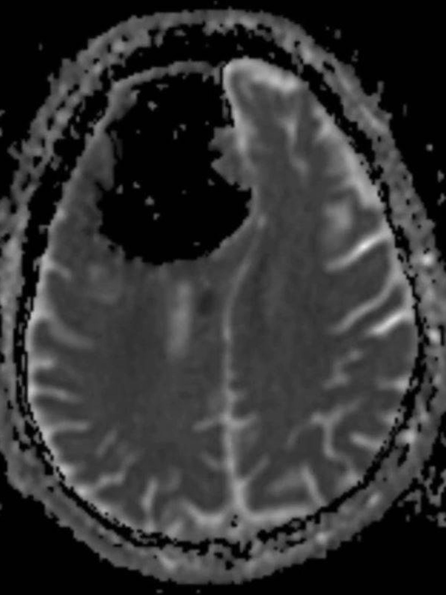 Imagen cenital de la radiografía. (BMJ Studies)