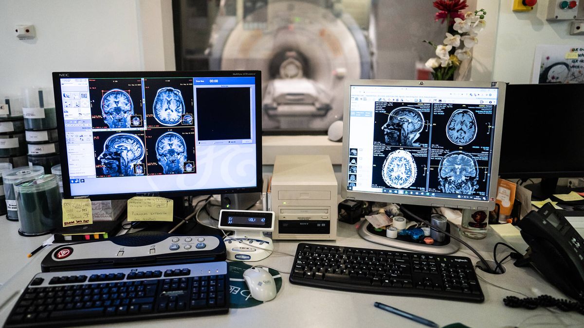 El mayor mapa del cerebro revela qué nos hace humanos y pistas sobre enfermedades