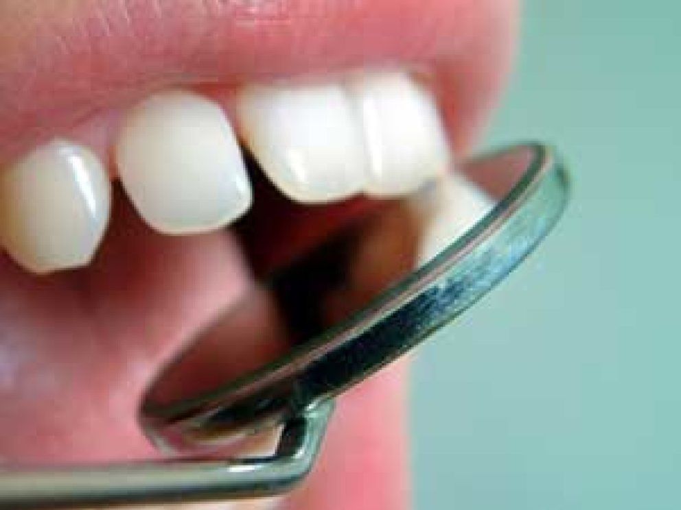 Foto: El uso prolongado de dentaduras postizas provoca pérdida de hueso y de encía