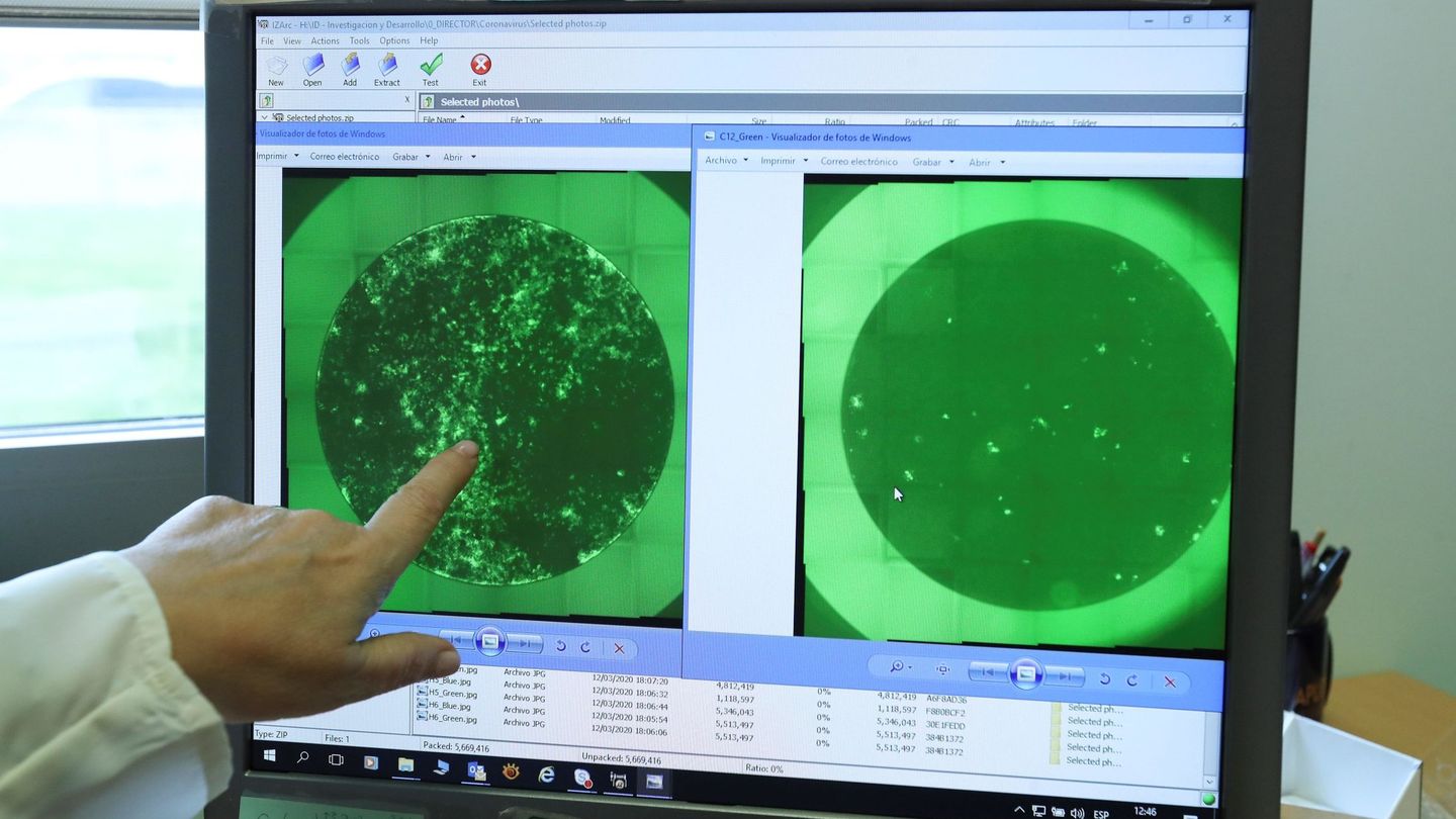 Una trabajadora de la empresa PharmaMar muestra las fotografías de una célula infectada con coronavirus COVID-19, (i), y la misma célula tras ser tratada con Aplidin (d). (EFE)