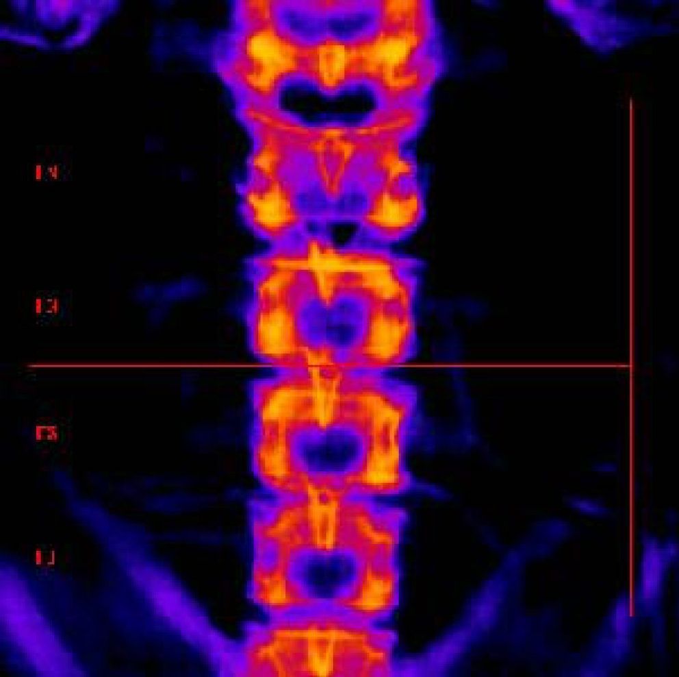 Foto: Una médula espinal de laboratorio