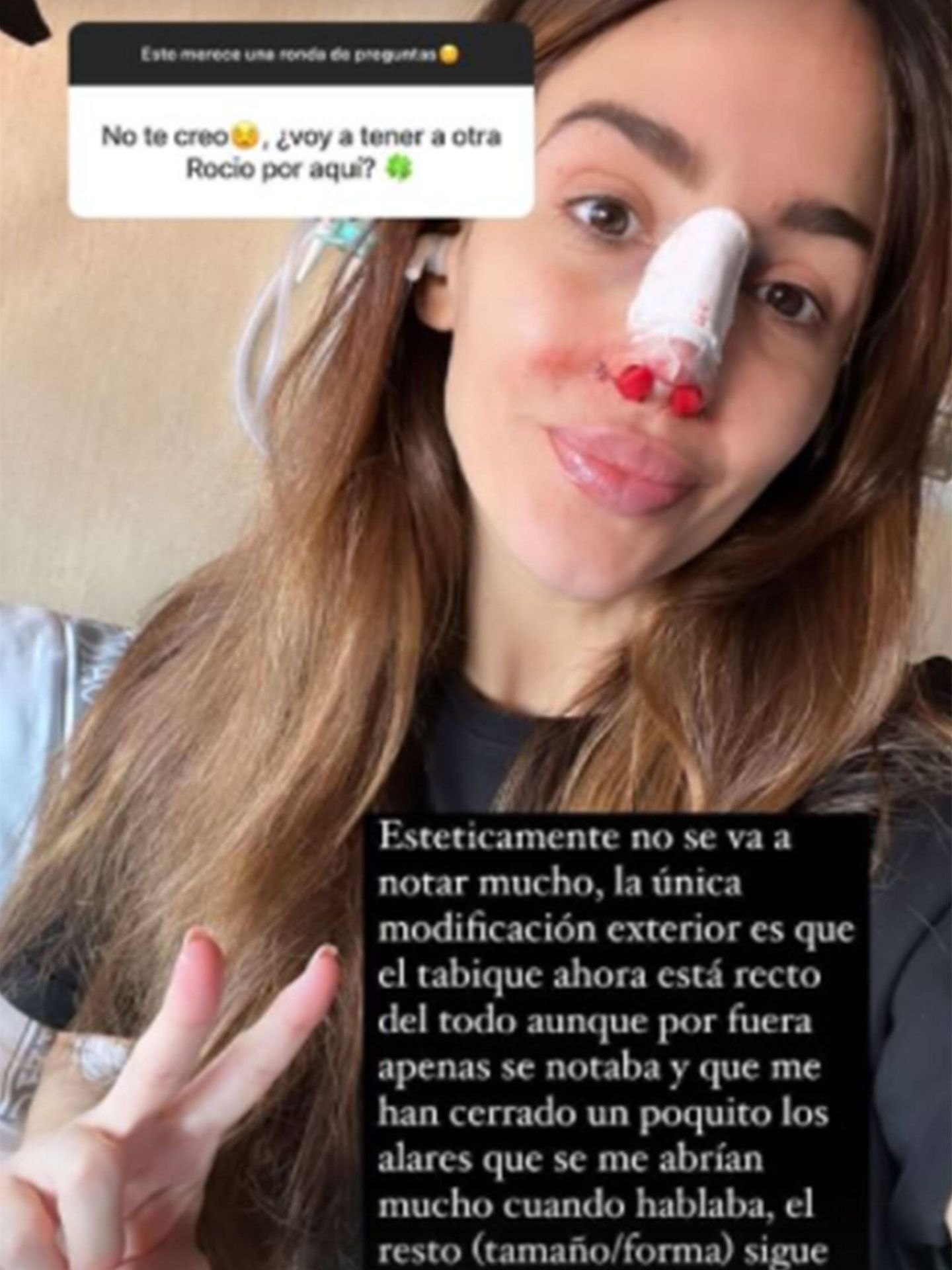 Rocío Osorno explica cómo ha sido su operación. (Instagram @rocio0sorno)
