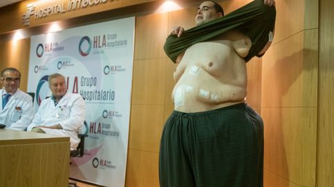 El aviso de Nueva Orleans a Andalucía y Galicia: el sobrepeso dispara la mortalidad