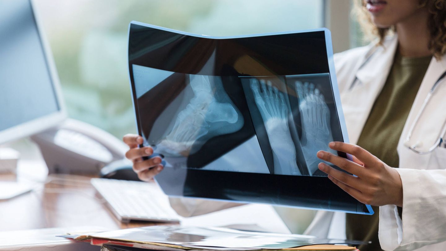 El diagnóstico siempre es por medio de imagen: radiografía o resonancia magnética. (iStock)