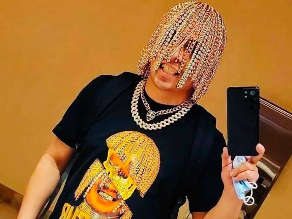 Sombreado Minero Monumental Dan Sur, el rapero que se ha implantado quirúrgicamente cadenas de oro en  la cabeza