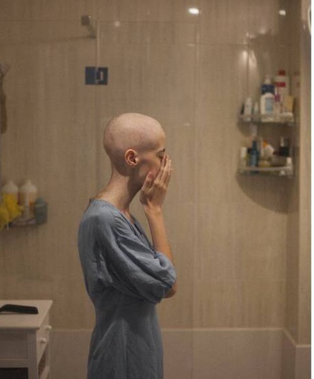 Foto: Olatz, después de raparse el pelo tras la quimioterapia. (Foto cedida)