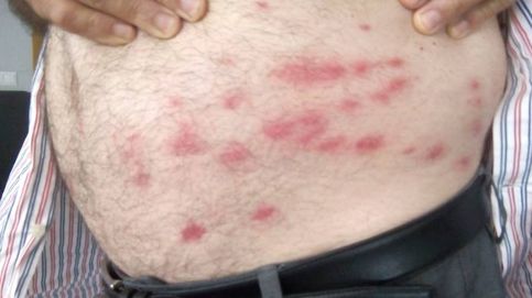 Así afecta la plaga de mosca negra: graves problemas y agricultores en urgencias