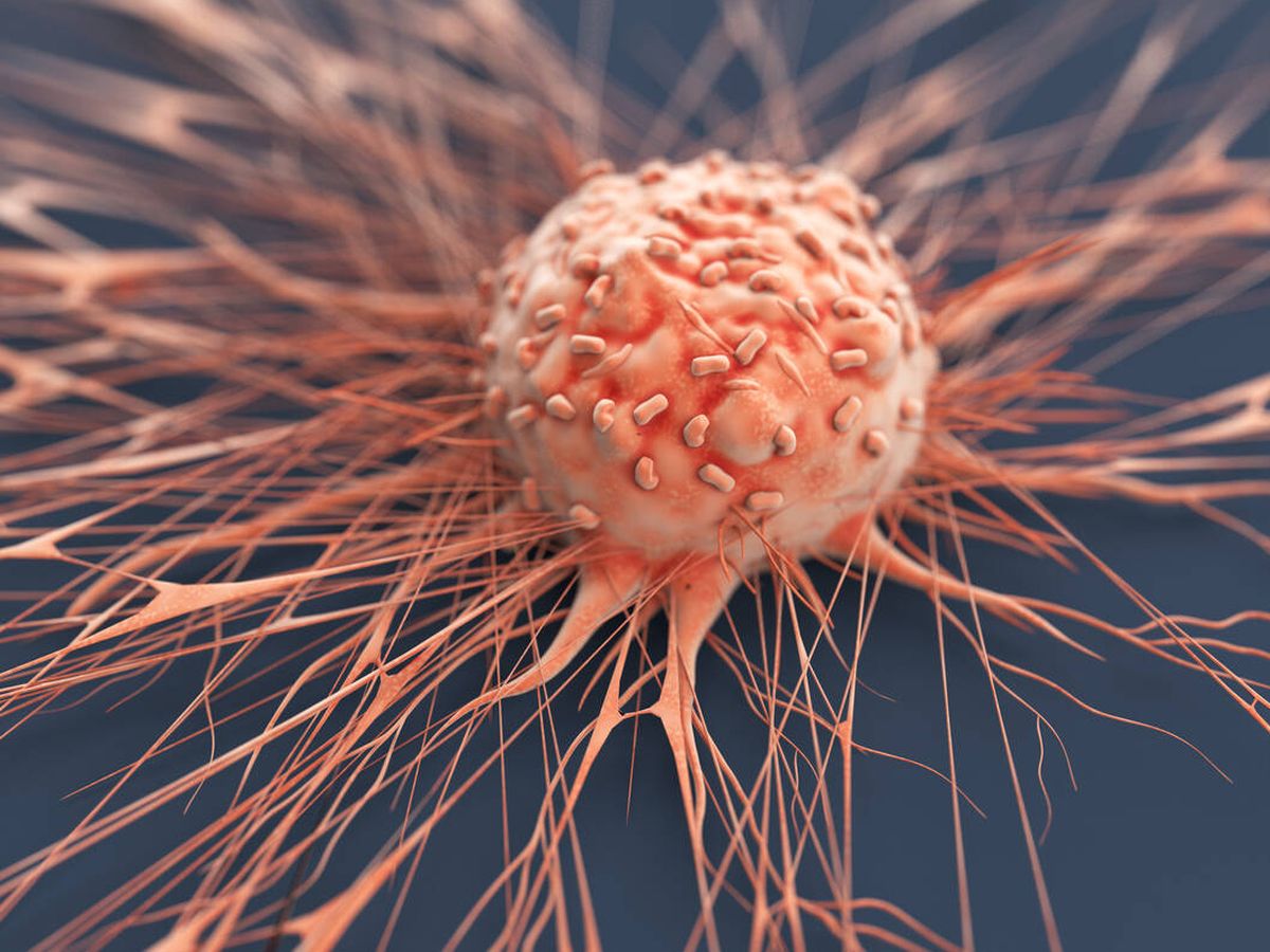 Foto: Célula de cáncer humano. (iStock)