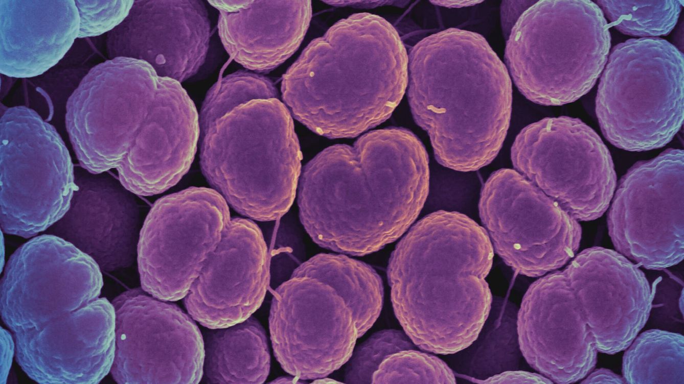 Foto: Micrografía electrónica de barrido de la bacteria Neisseria gonorrhoeae, que causa la gonorrea. (NIH)