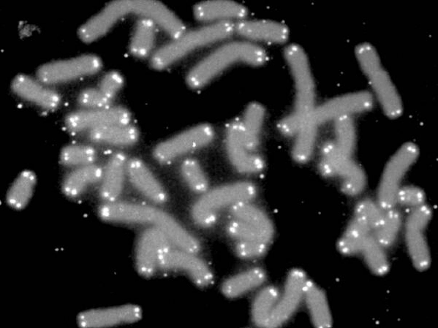 Cromosomas humanos (en gris) con sus telómeros (blancos) vistos al microscopio. (Wikipedia)