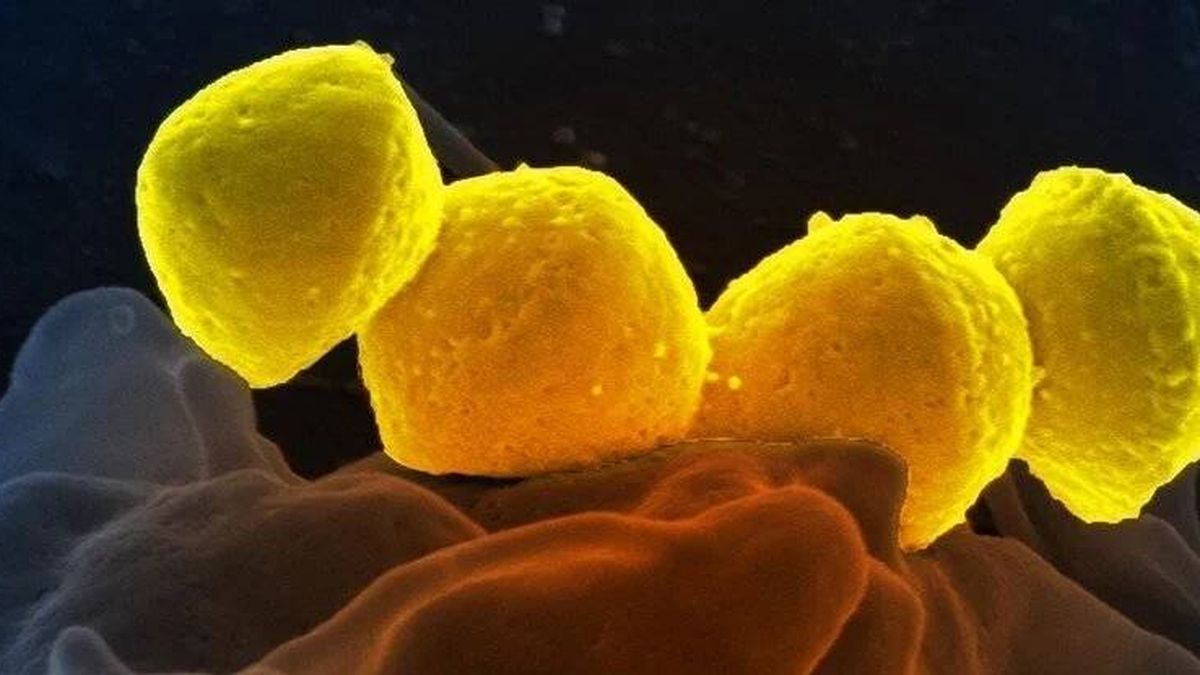 La escarlatina ha evolucionado: científicos alertan del regreso de este patógeno