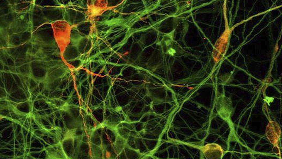 Identifican neuronas clave para el tratamiento del autismo