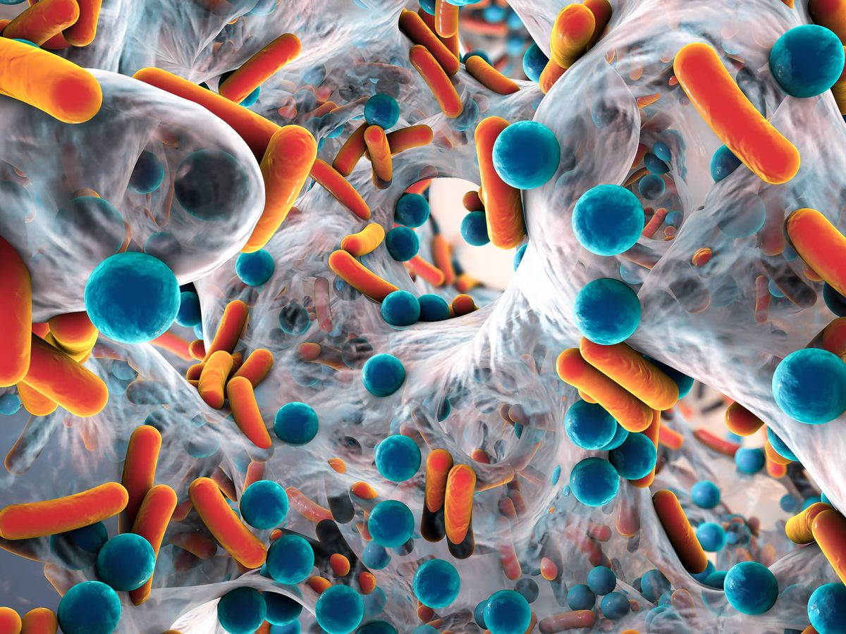Foto:  Biofilm de bacterias resistentes a los antibióticos (Fuente: iStock)
