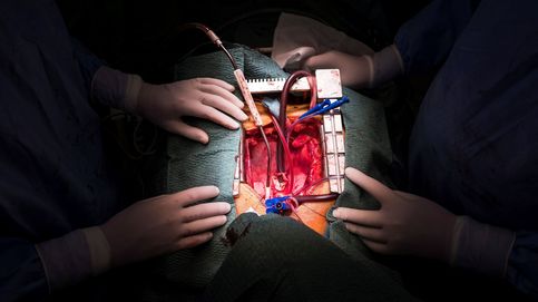 Primer trasplante de músculo cardiaco: ¿el fin de los trasplantes de corazón?