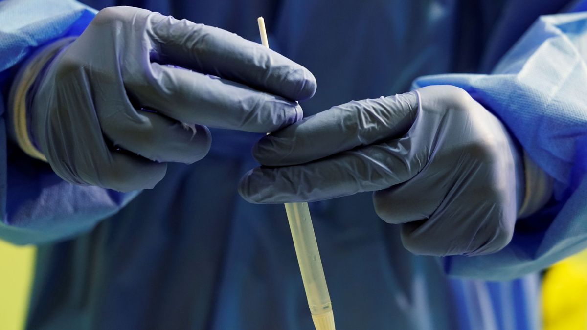 El CSIC ofrece a la OMS su tecnología para la fabricación de test serológicos en África