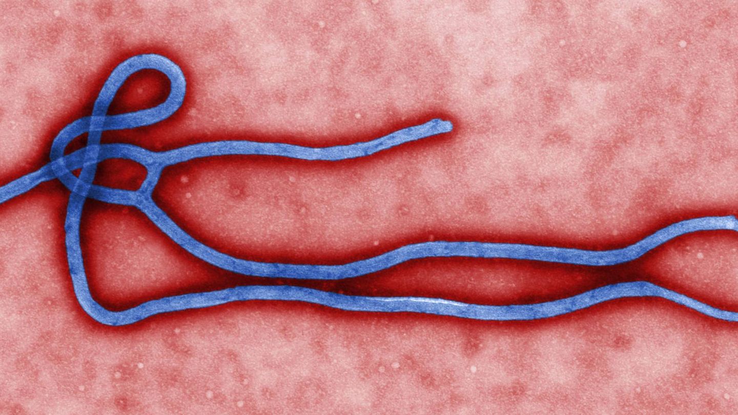 Virus del ébola visto en un microscopio. (Wikimedia Commons)
