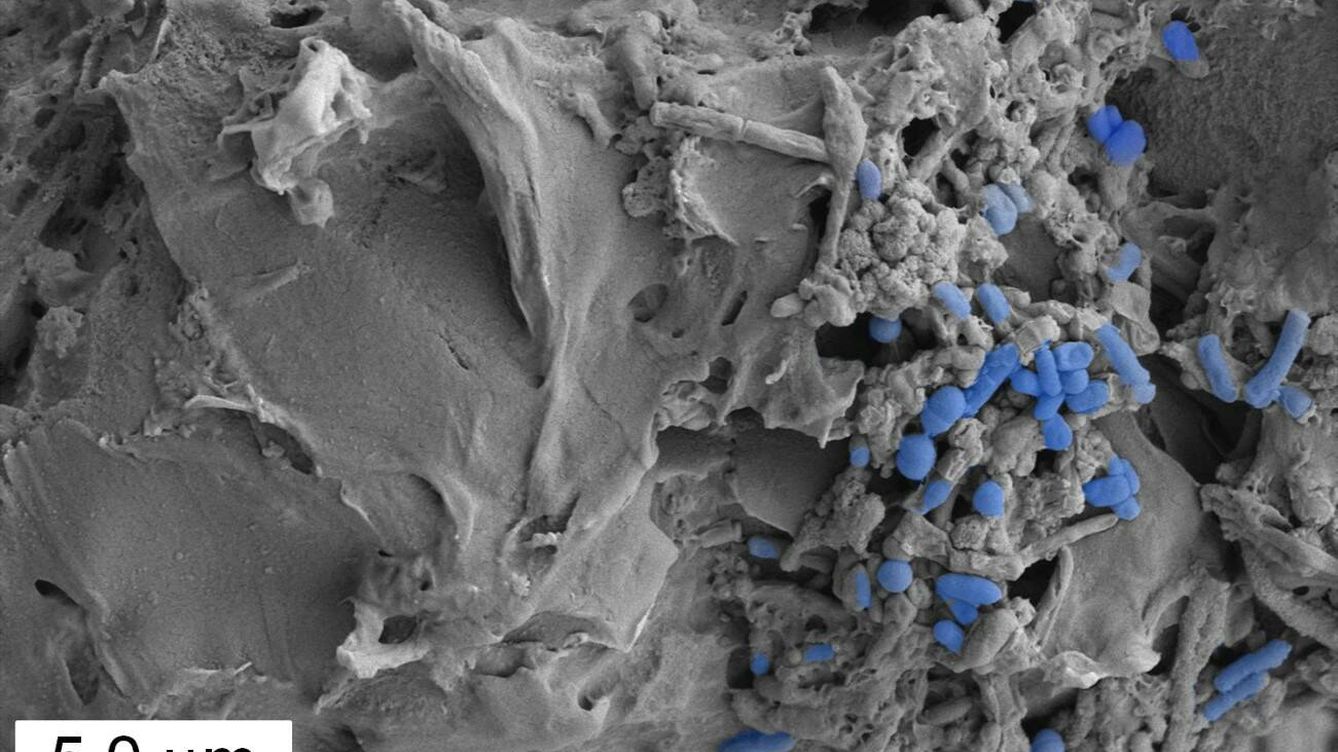 Foto: Imagen microscópica de microplásticos colonizados por la microbiota intestinal. (CSIC)