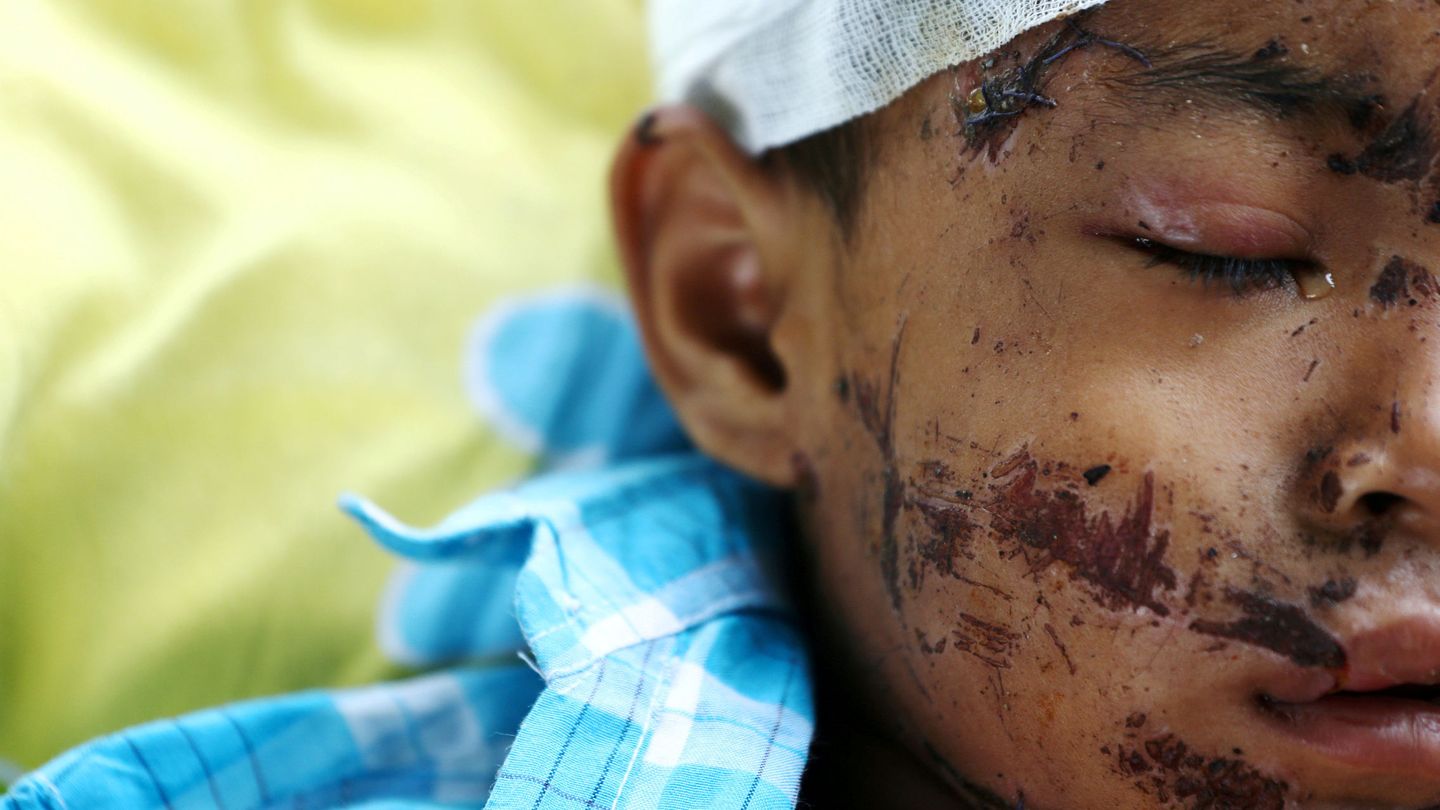 Niño herido en el terremoto de Indonesia en 2018 (Reuters)