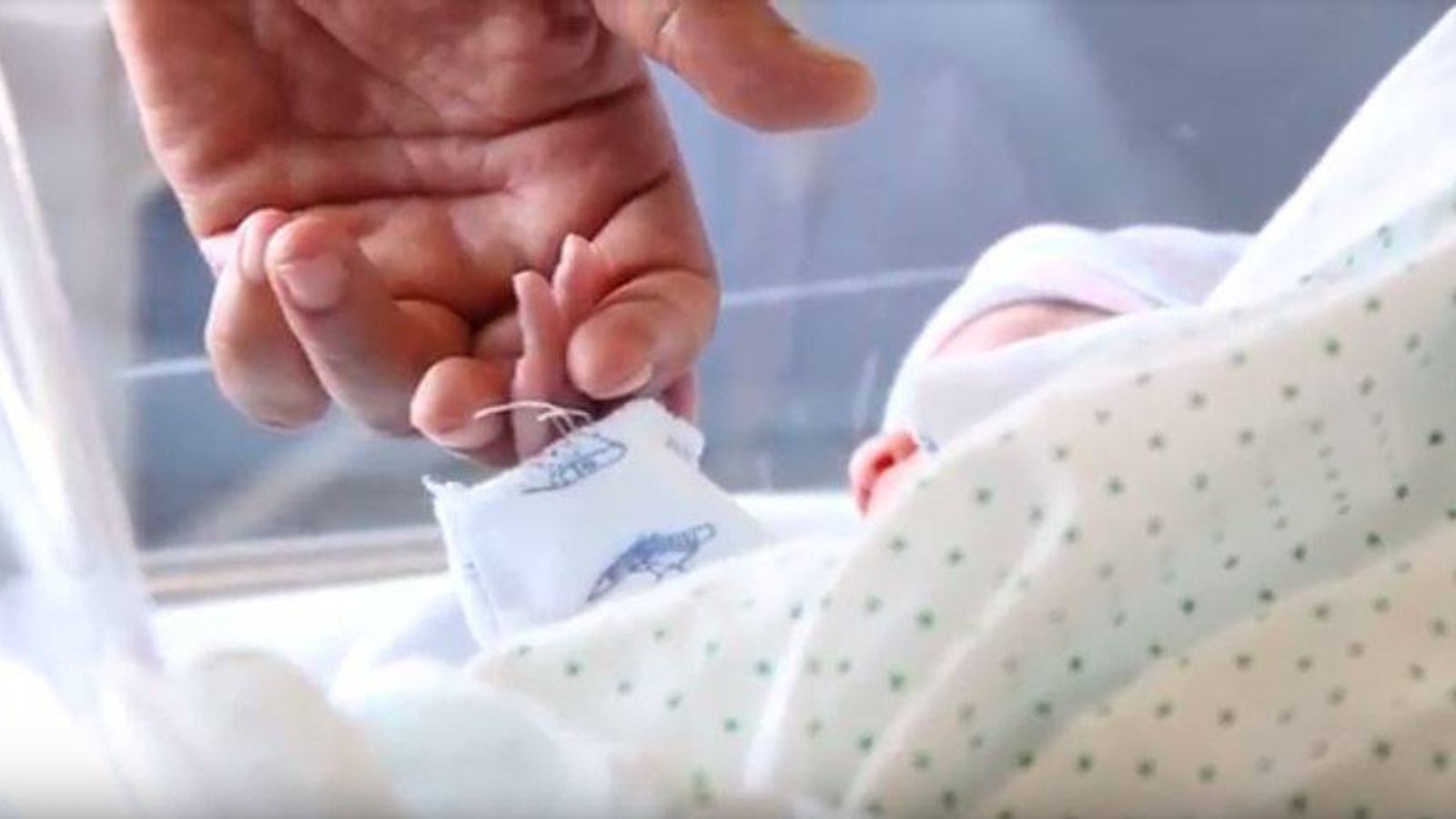 Foto: Este bebé salvará a su hermano gracias a un trasplante de médula.