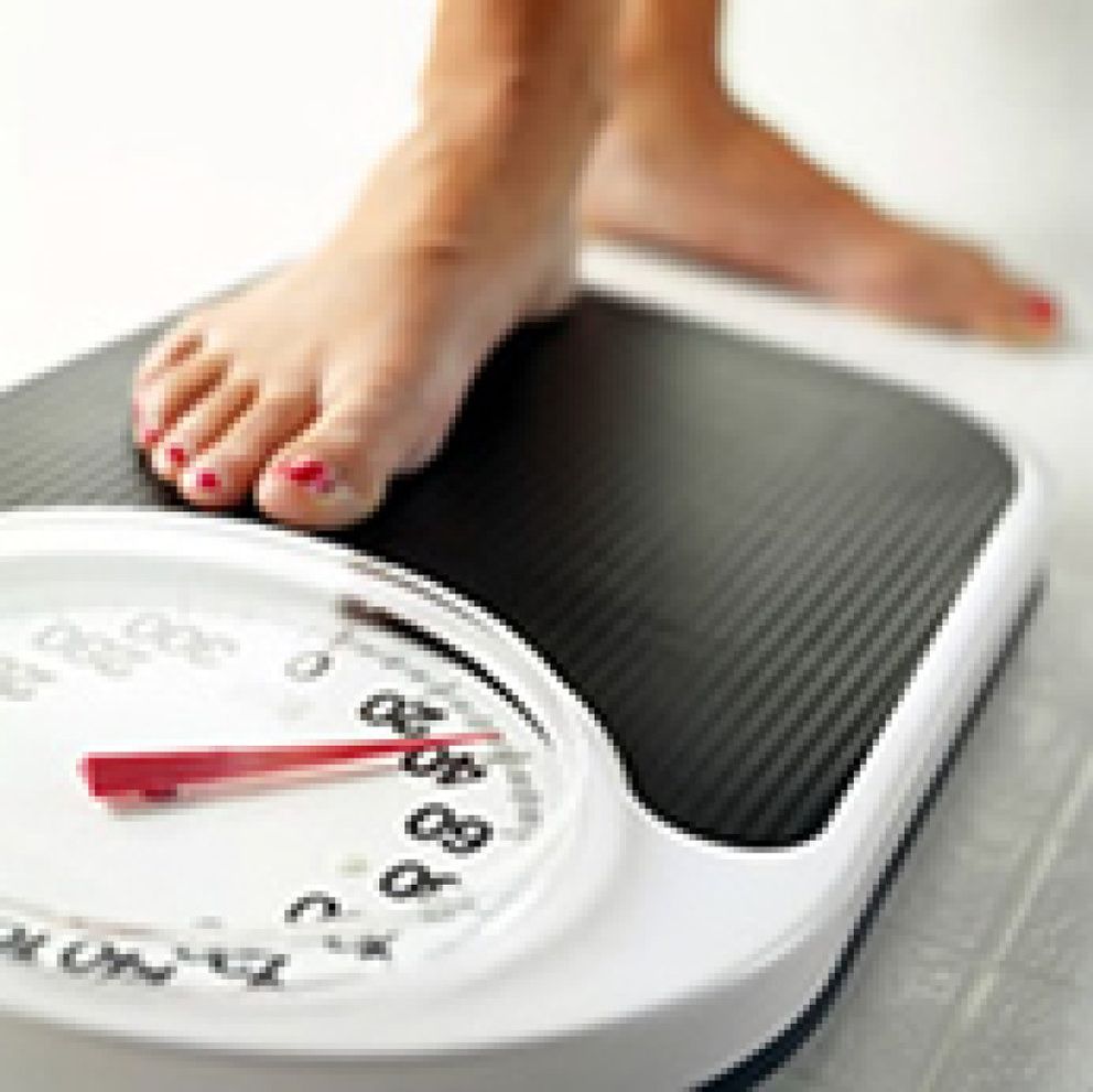 Foto: La mitad de los pacientes con sobrepeso sufren síndrome metabólico