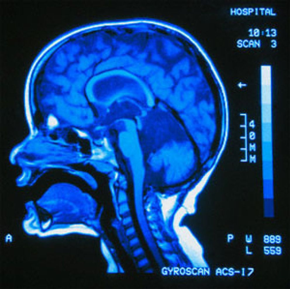 Foto: Escáneres cerebrales revelan disfrute con el dolor ajeno en agresores juveniles