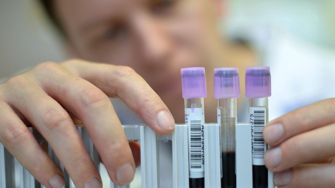 Un pionero análisis de sangre puede mejorar tu tratamiento oncológico
