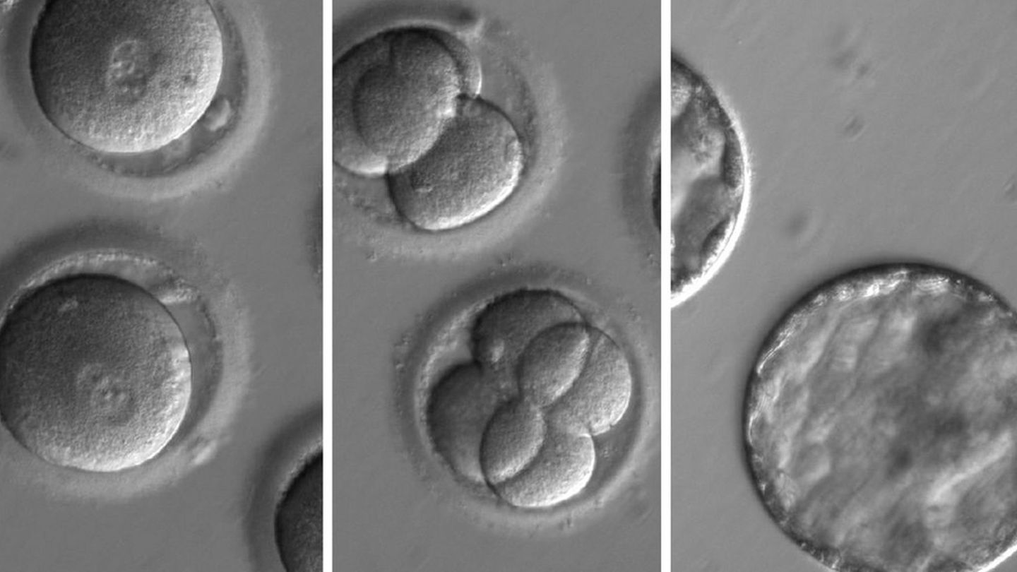Científicos usan CRISPR para corregir la mutación genética causante de la miocardiopatía hipertrófica en embriones humanos. (EFE)
