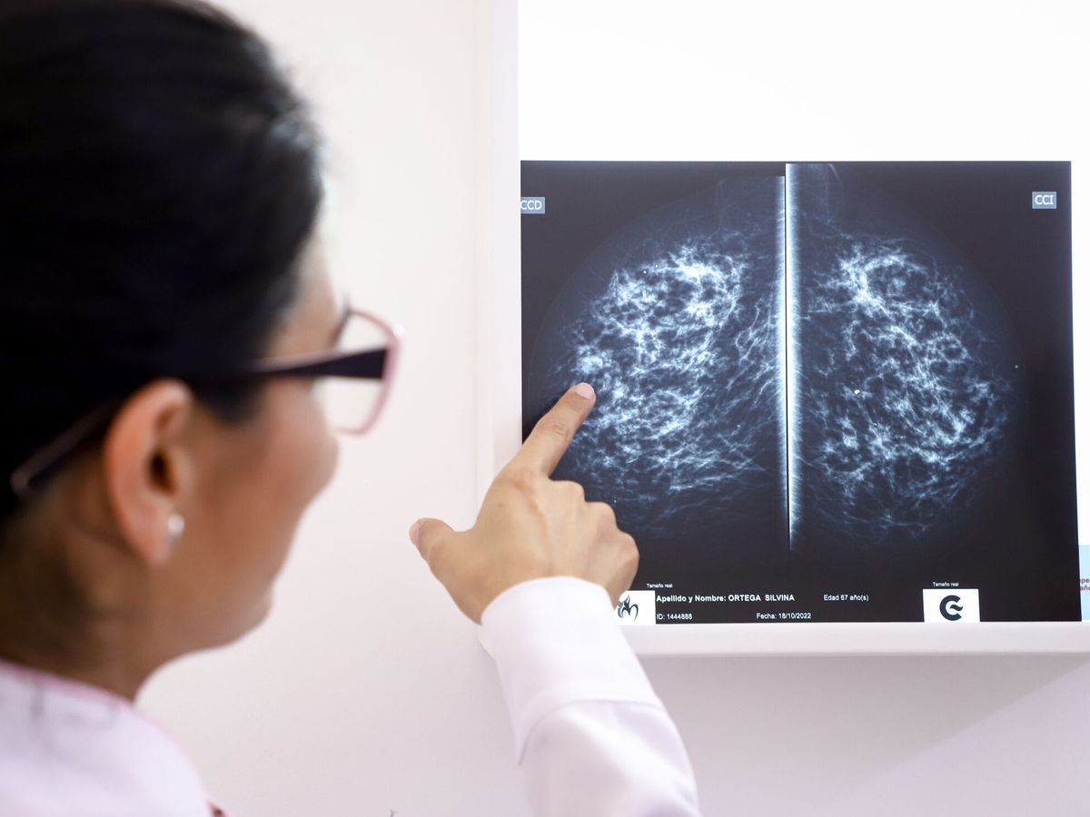 Foto: Una doctora observa un examen de rayos X. (EFE/Nathalia Aguilar)