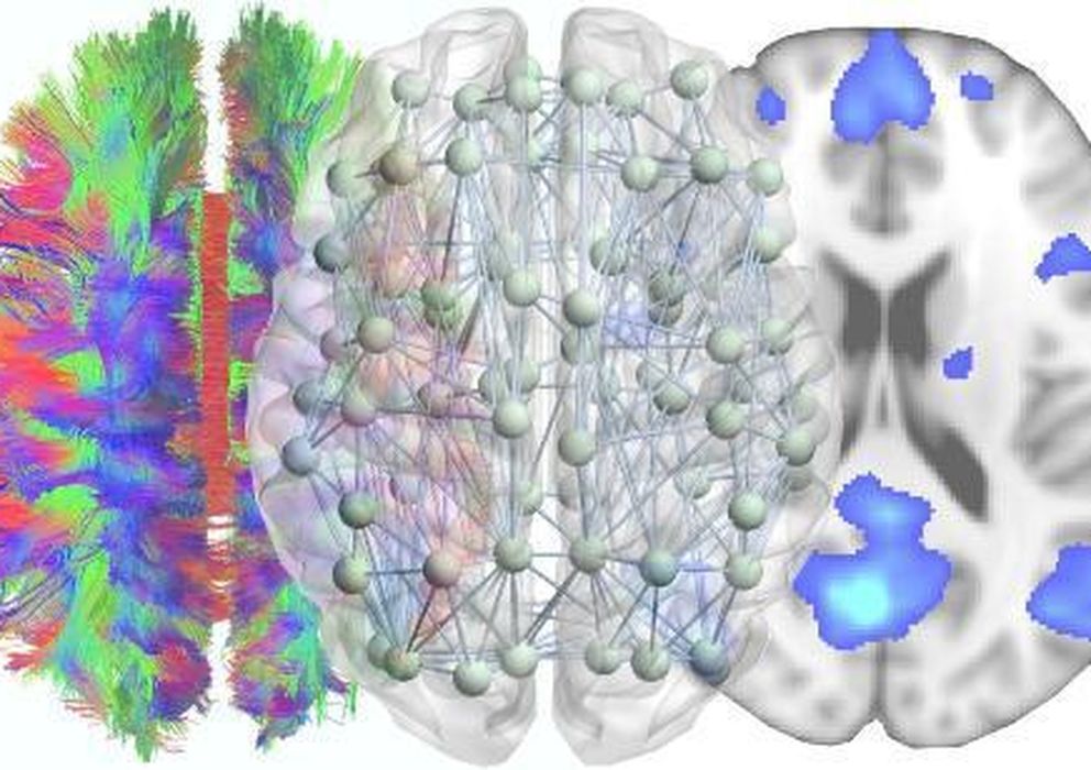 Foto: De izquierda a derecha: mapa de tractos obtenido, red cerebral macroscópica, red por defecto de un sujeto sano obtenida a partir de una adquisición de resonanci